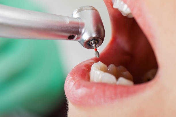 Best Dental Abscess Treatment in Sierra Vista Southeast, AZ